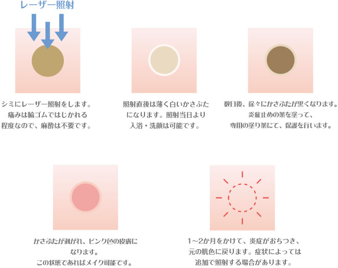 ピコスポット(シミ取り)